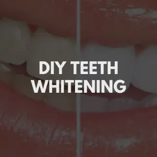 /img/33102-professional-whitening-vs-diy.webp