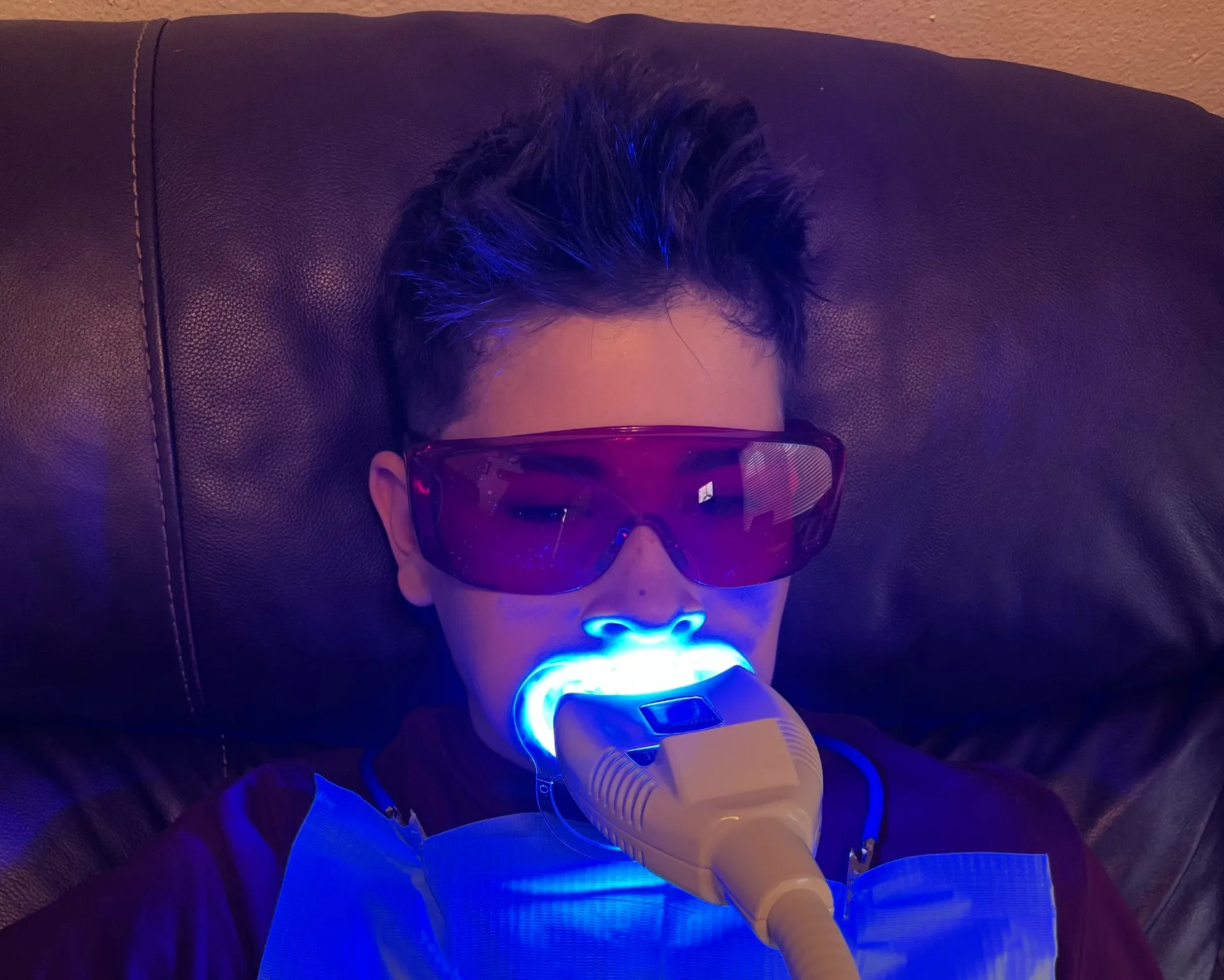 33110 over the counter teeth whitening