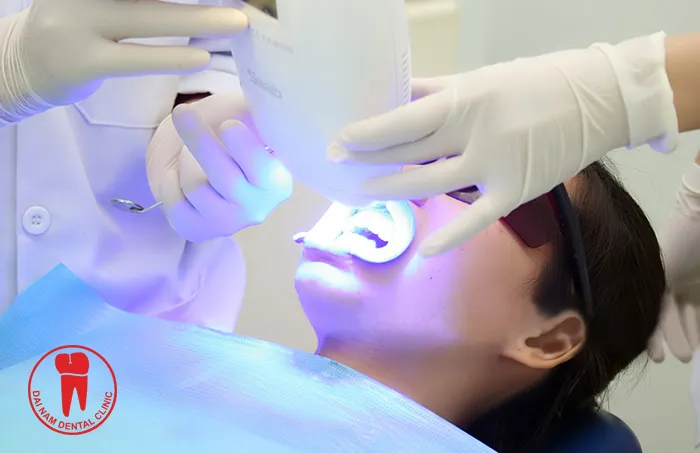 /img/33110-teeth-whitening-aftercare.webp