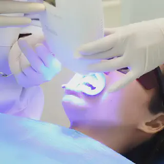 /img/33110-teeth-whitening-aftercare.webp
