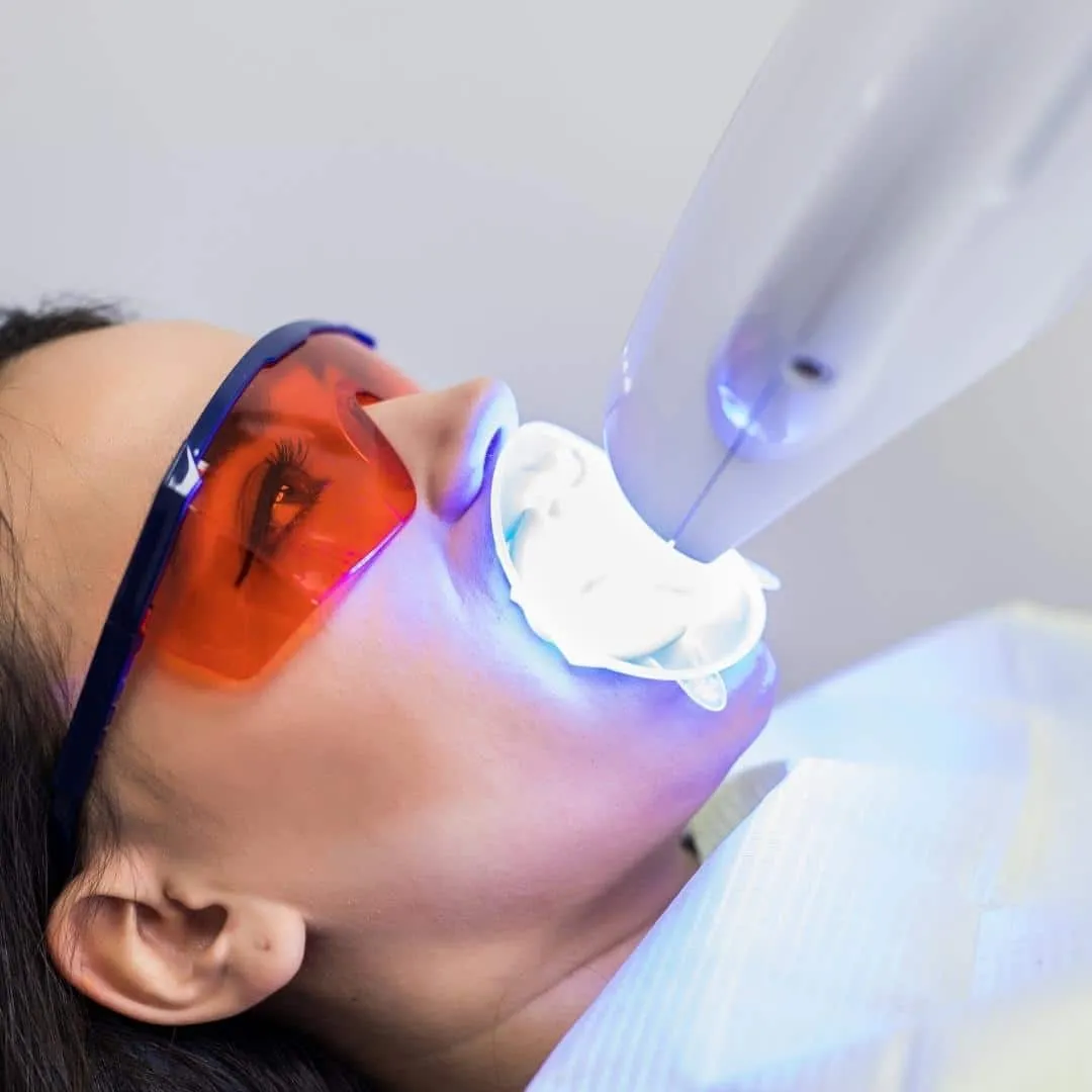 33110 teeth whitening vienna va header