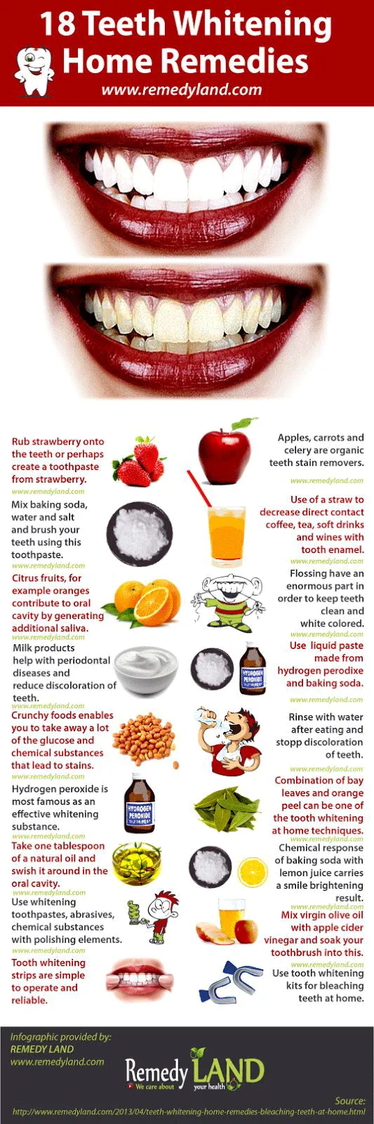 33111 fluoride treatment