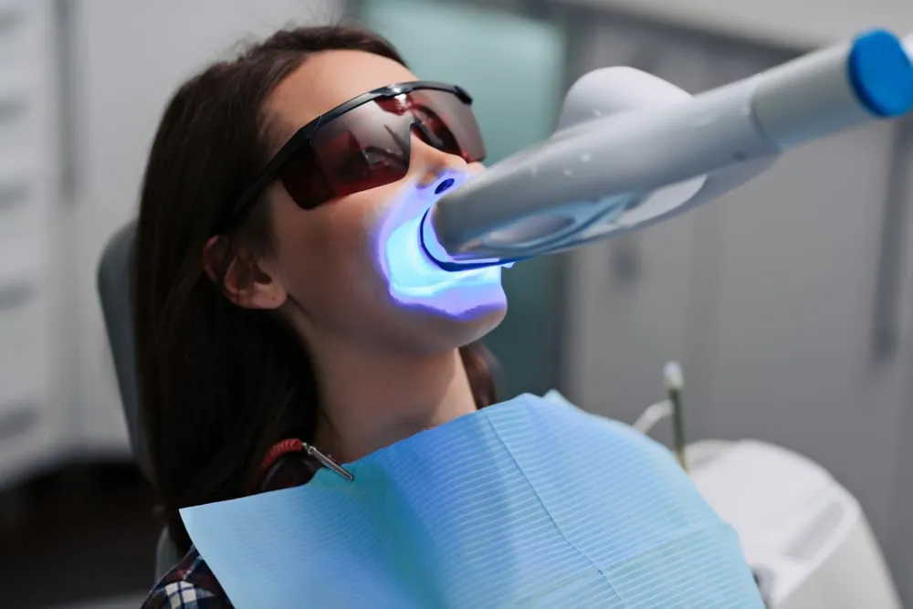 /img/33111-professional-teeth-whitening.webp