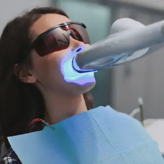 /img/33111-professional-teeth-whitening.webp