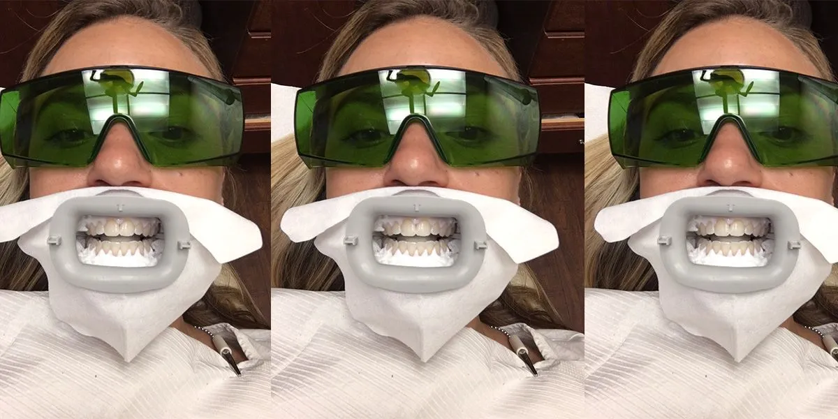 33111 teeth whitening pain relief