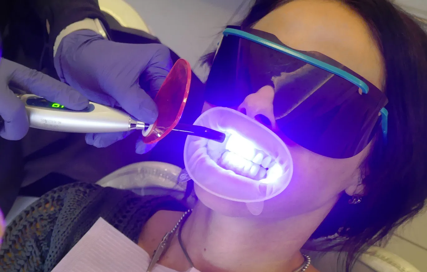 33114 uv whitening dangers teeth image1