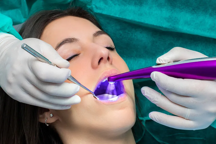 33114 uv whitening dangers teeth image4