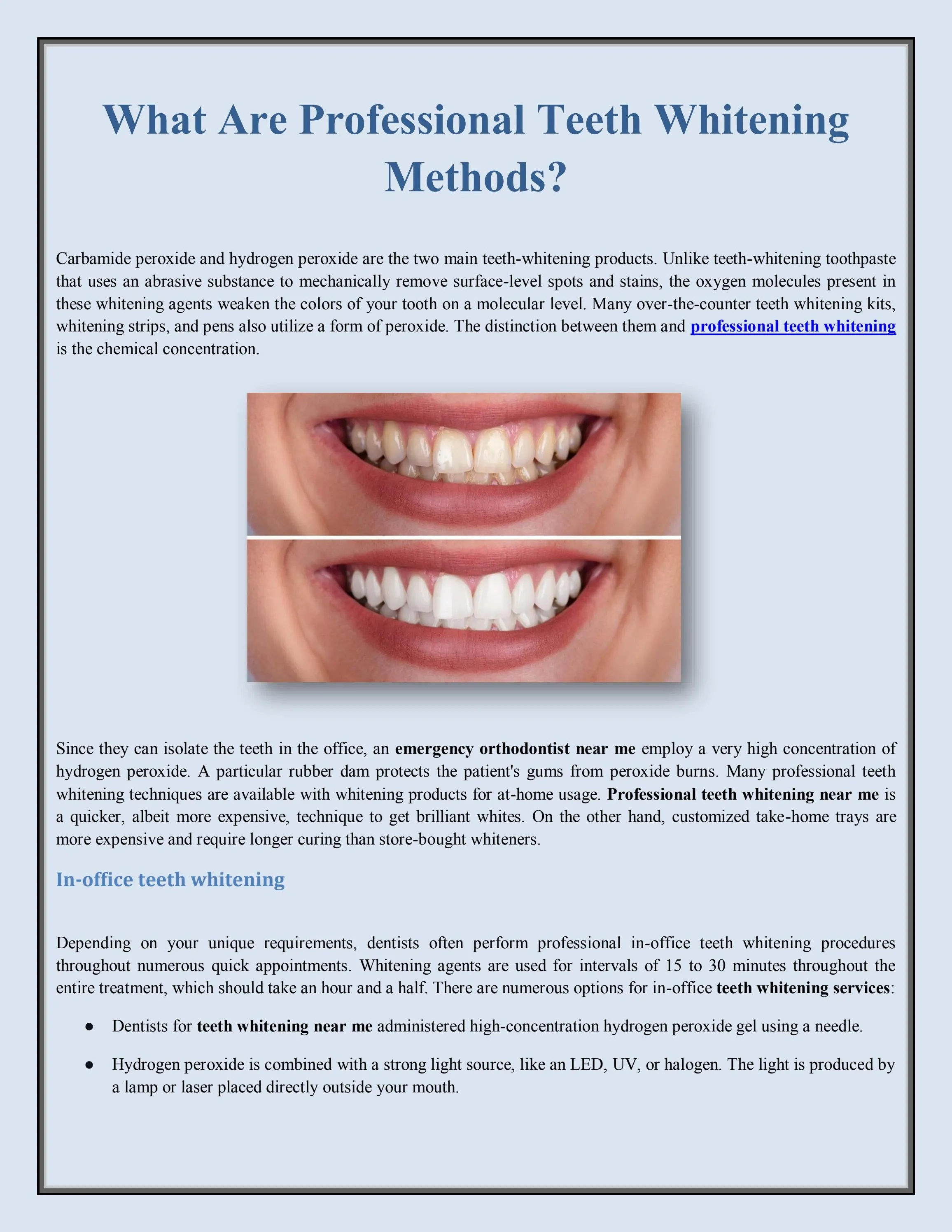 33122 teeth whitening methods 1