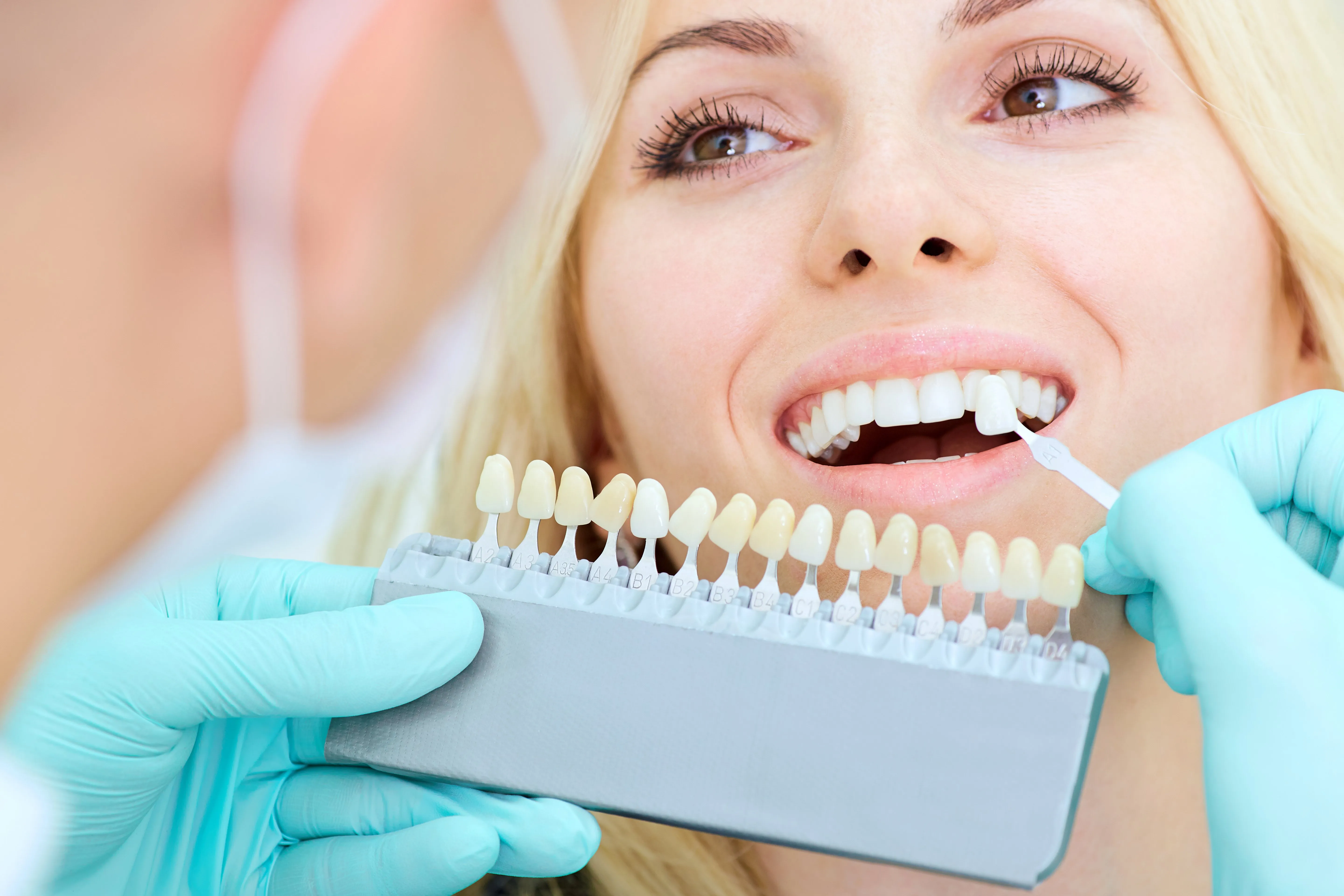 33122 teeth whitening methods 5