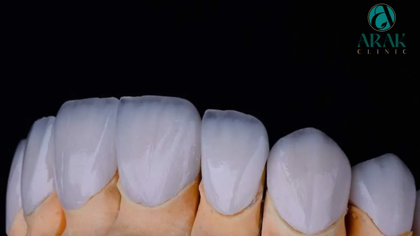 /img/33126-zoom-teeth-whitening-maintenance.webp