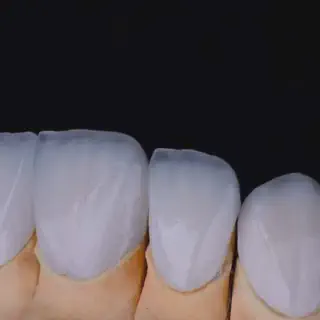 /img/33126-zoom-teeth-whitening-maintenance.webp