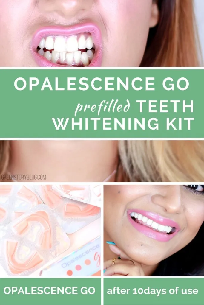 33130 convenient teeth whitening