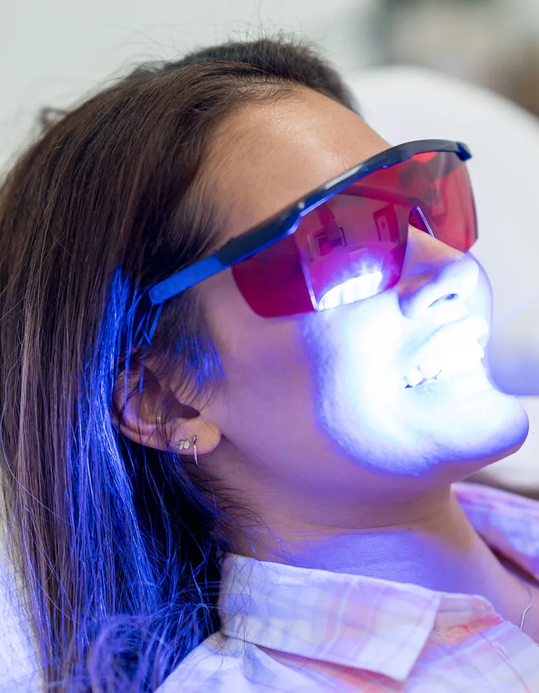 33131 at home teeth whitening kits