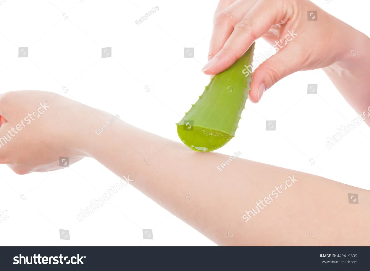 33134 aloe vera inflammation