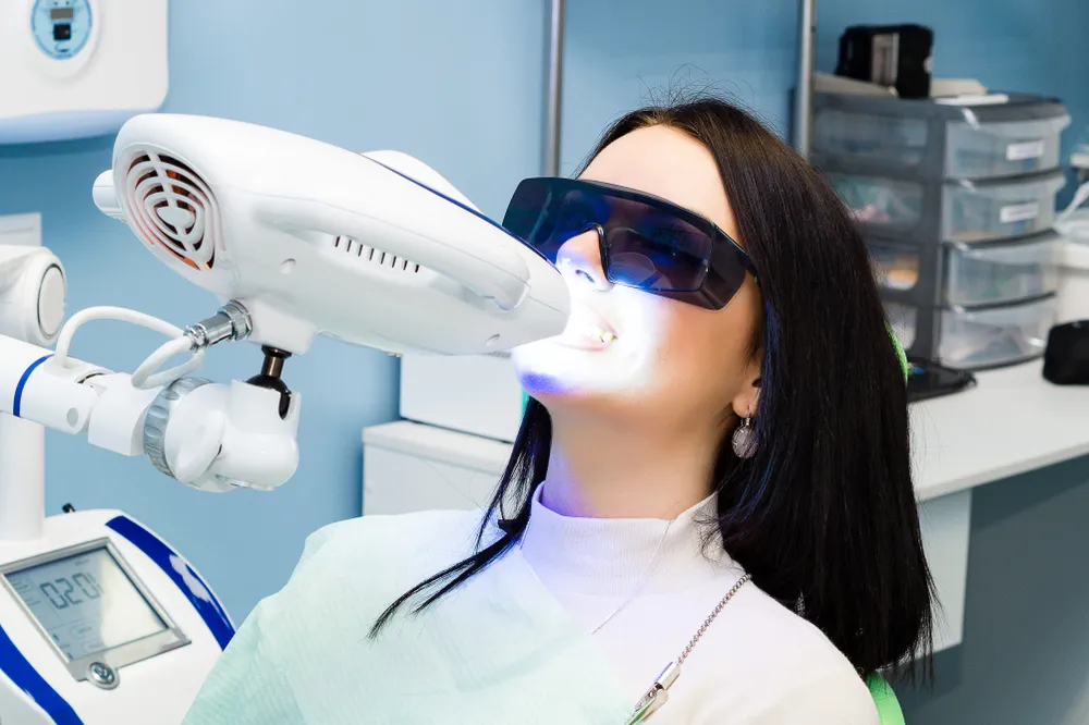 33139 laser whitening carlisle before after