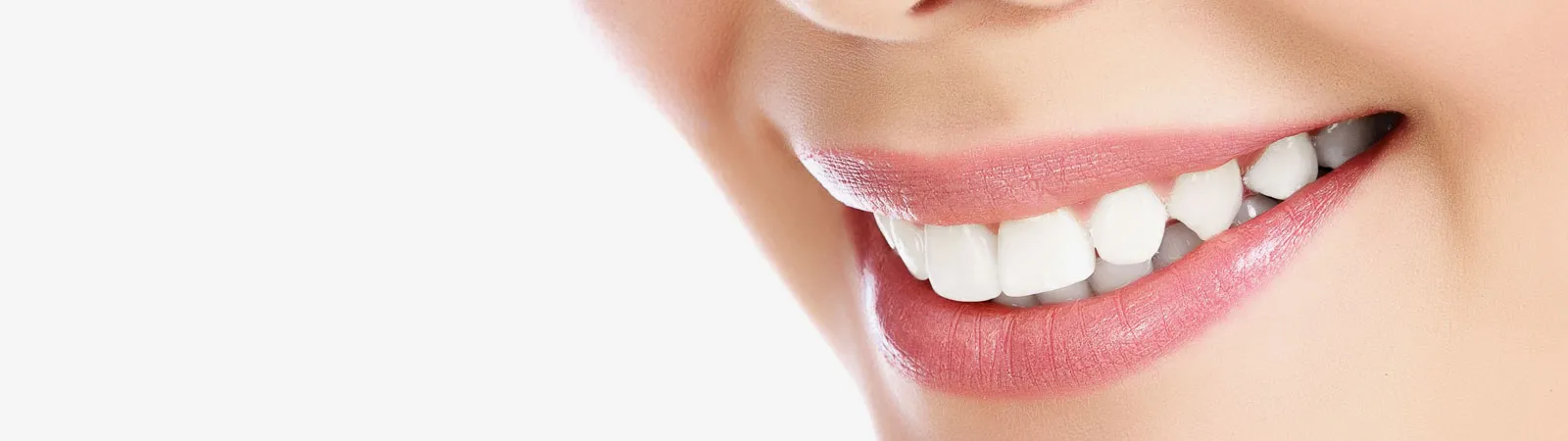 33139 laser whitening carlisle laser treatment