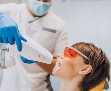 33139 laser whitening carlisle whitening gel application