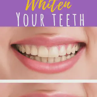 /img/33140-bright-smile-diet.webp