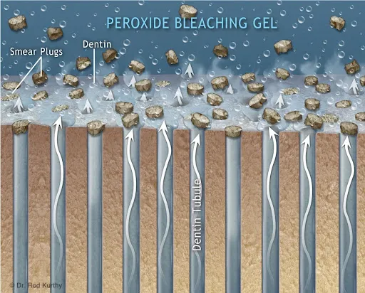 33142 peroxide skin whitening science