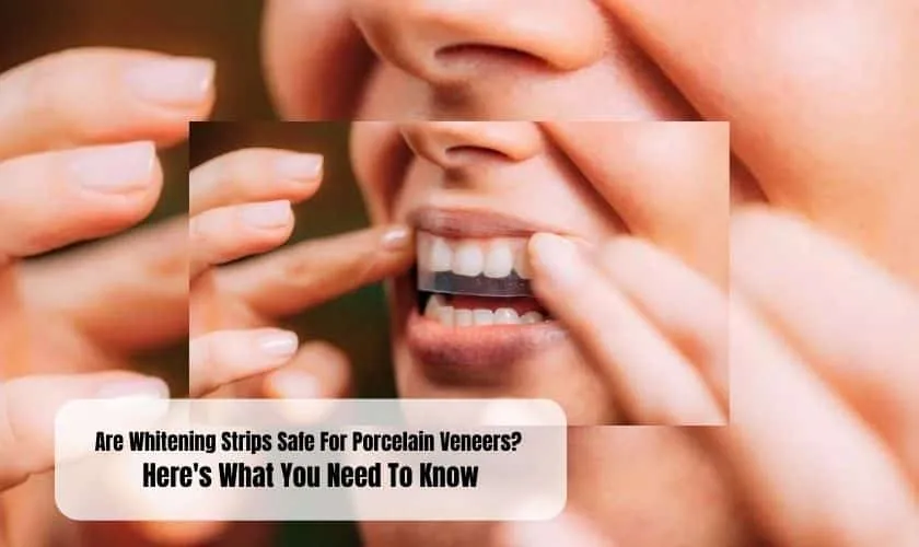 33143 professional teeth whitening