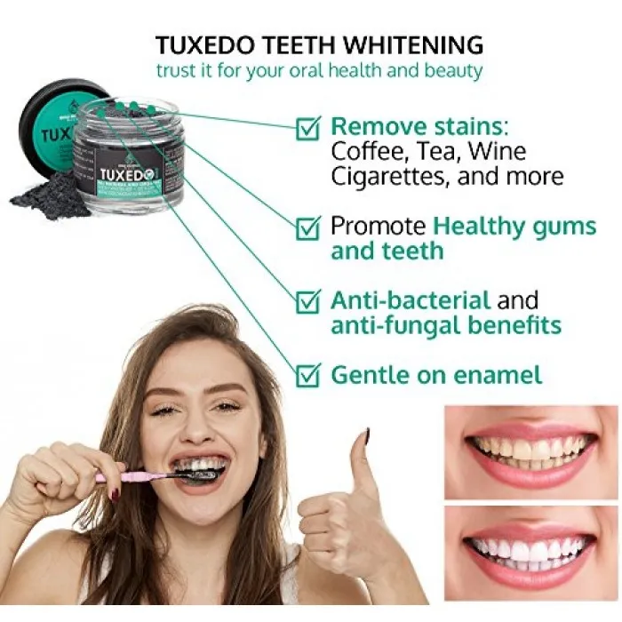 33150 tuxedo charcoal teeth whitening before after
