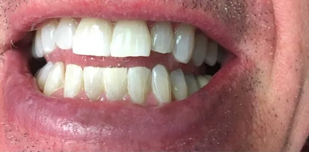 /img/33152-dentist-consultation.webp