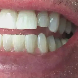 /img/33152-dentist-consultation.webp