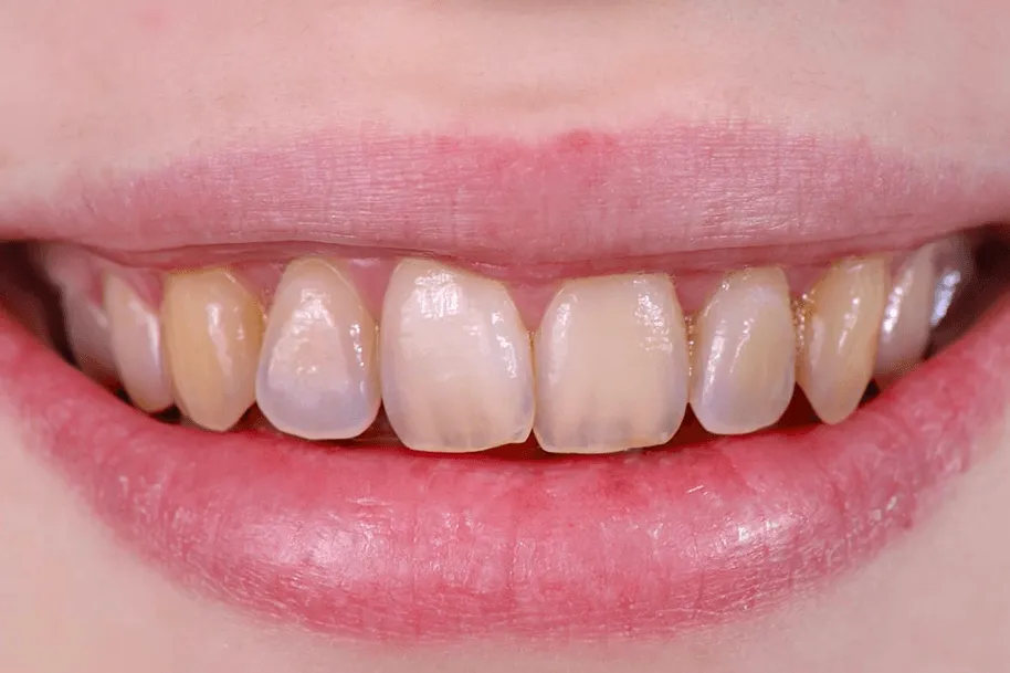 /img/33154-oral-hygiene.webp