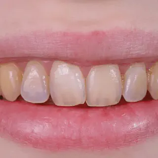 /img/33154-oral-hygiene.webp
