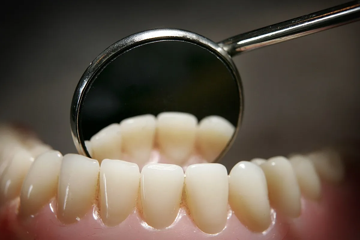 33154 peroxide teeth whitening