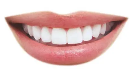 33158 teeth whitening torrance dental office