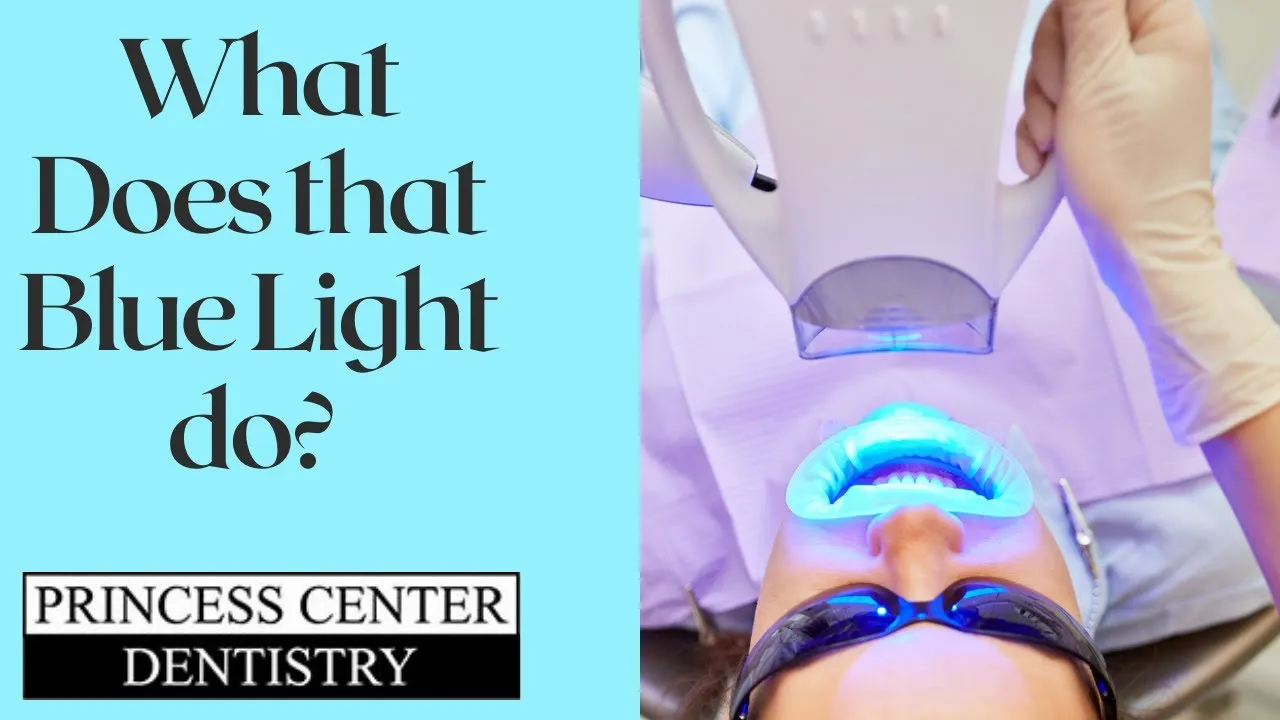 33160 led teeth whitening