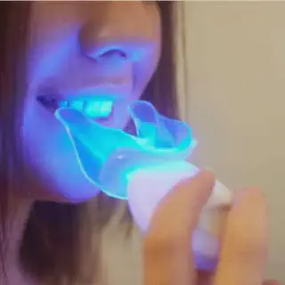 /img/33160-teeth-whitening-light-aftercare.webp