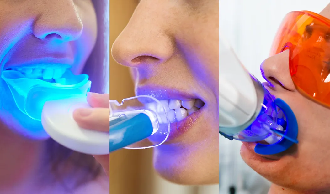 33160 uv teeth whitening