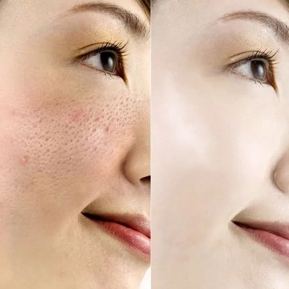 33161 oral medications skin whitening