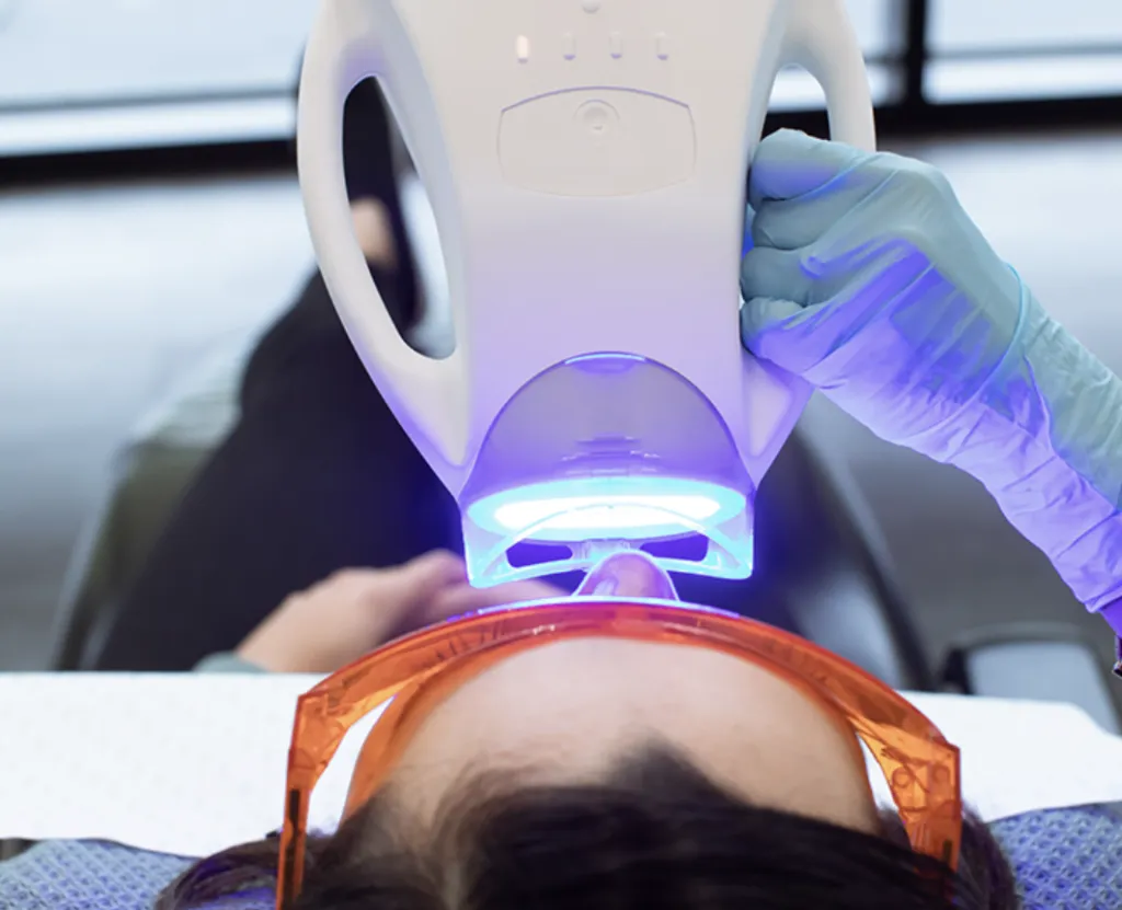 33162 invisalign and teeth whitening 4
