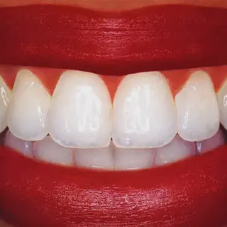 /img/33164-dental-checkups.webp
