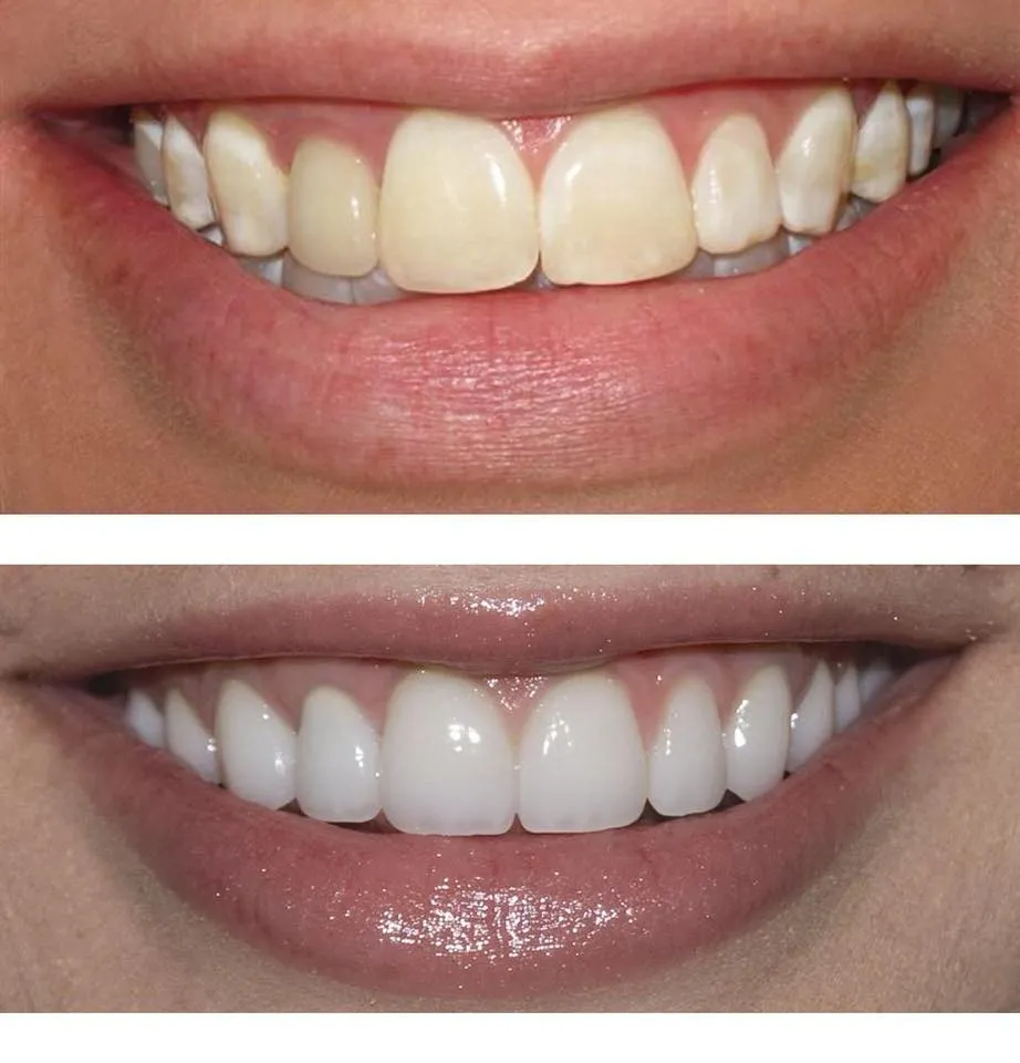 33165 qualified dentist yorkshire