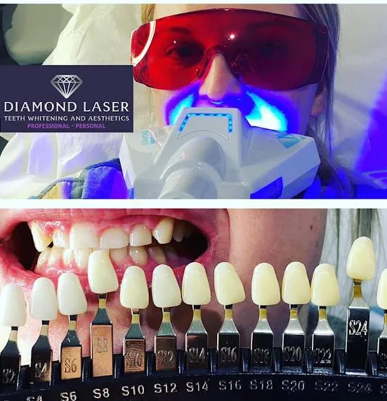 33165 teeth whitening smile