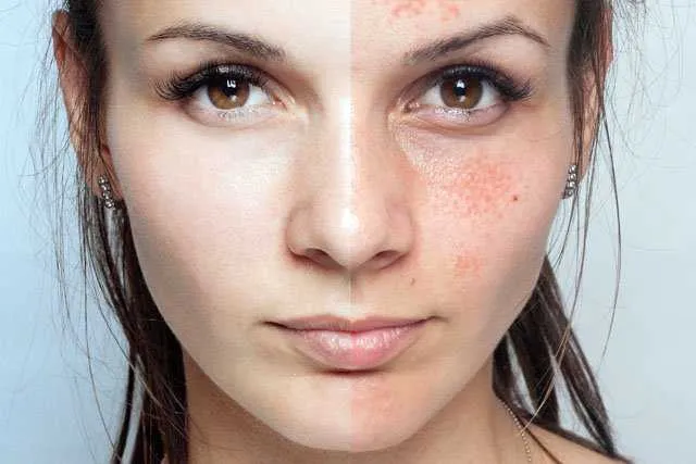 /img/33166-glowing-skin-tips.webp