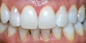 /img/33175-bright-smile.webp