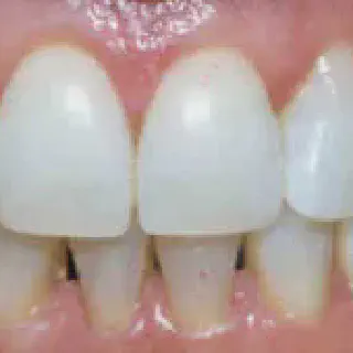 /img/33175-bright-smile.webp