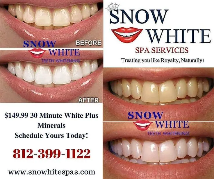 33176 flossing teeth stjohns