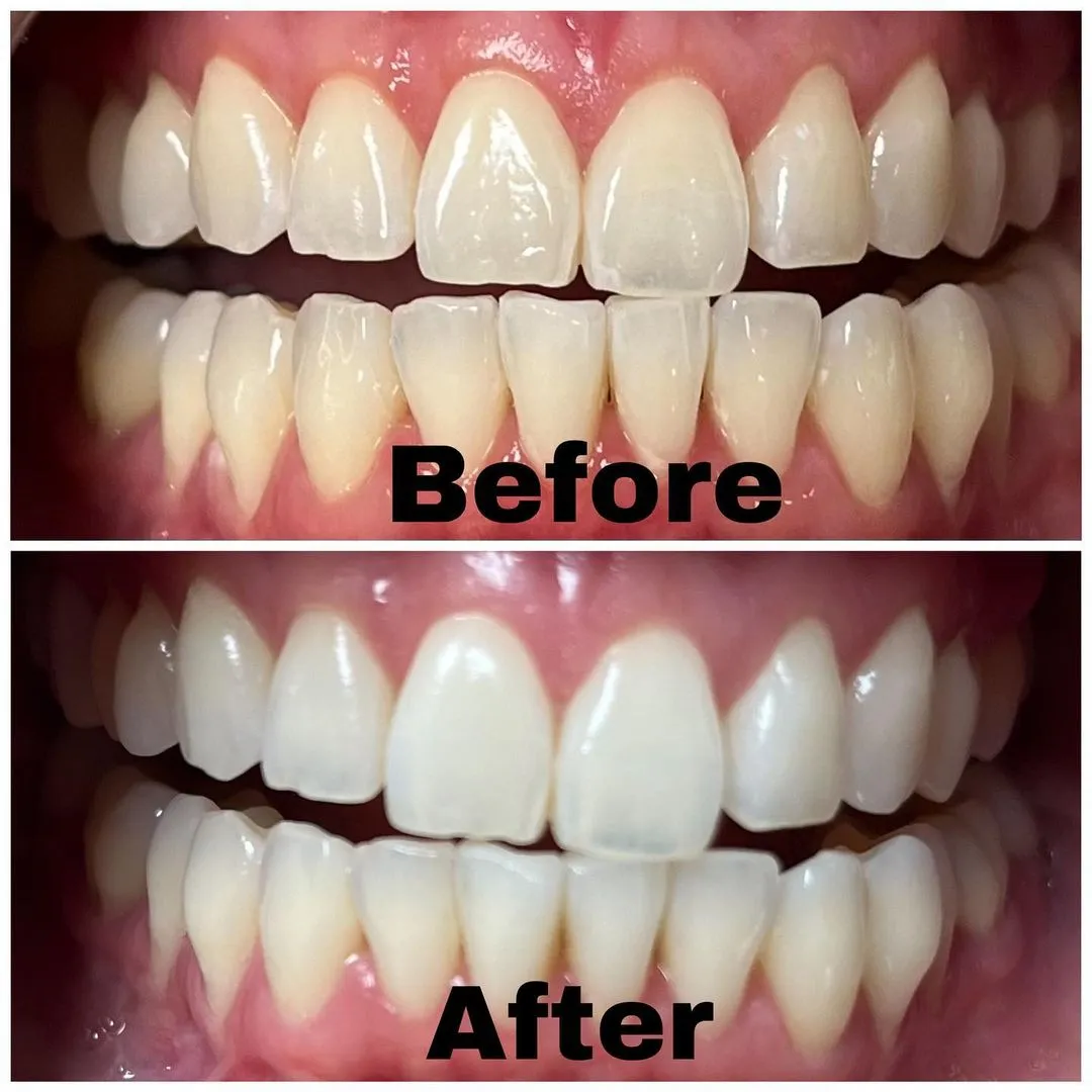 33176 foods for teeth stjohns