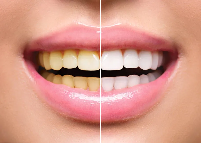 33179 oral hygiene