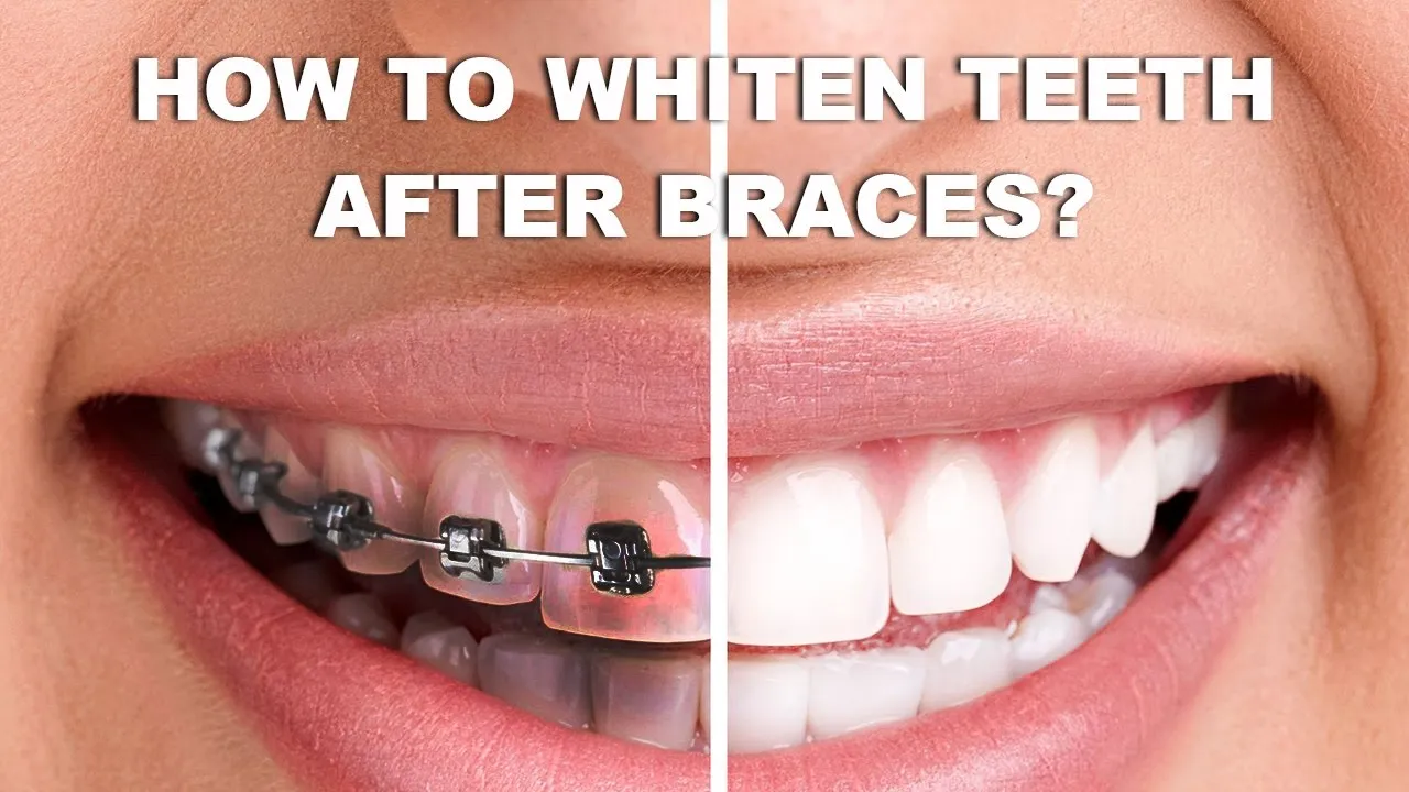 33179 sensitivity teeth