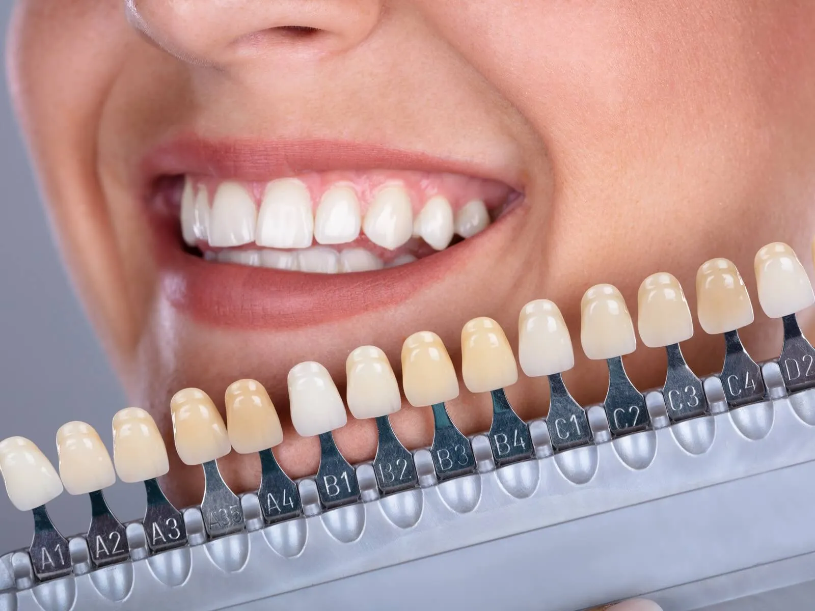 /img/33180-regular-dental-checkups.webp