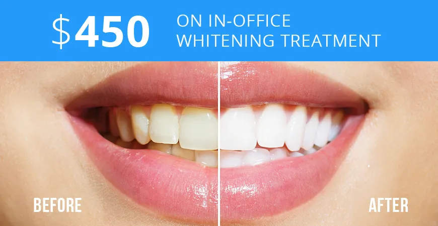 33181 teeth whitening cost dentist office 3