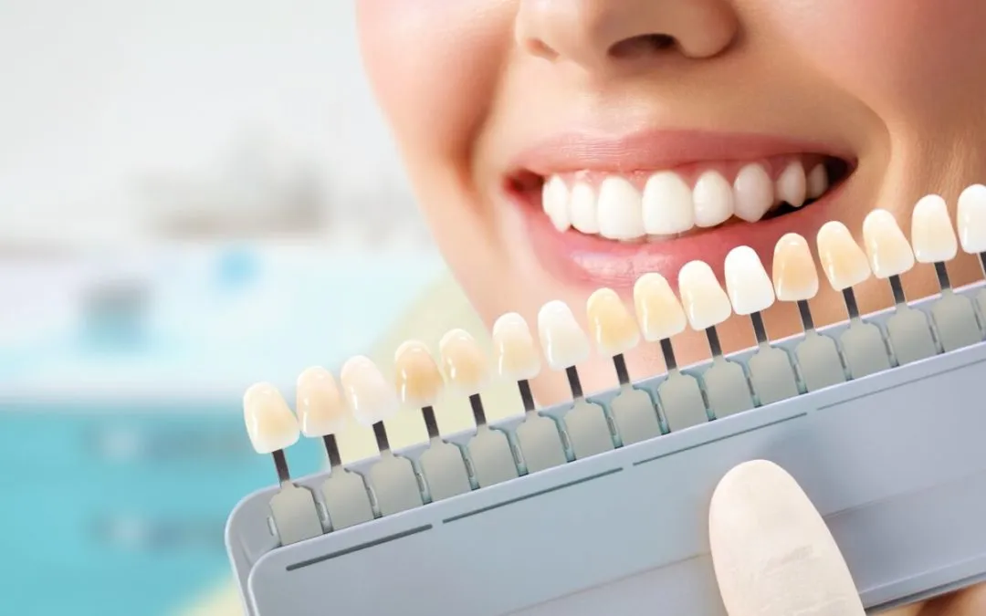 /img/33181-teeth-whitening-cost-dentist-office-7.webp