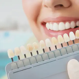 /img/33181-teeth-whitening-cost-dentist-office-7.webp